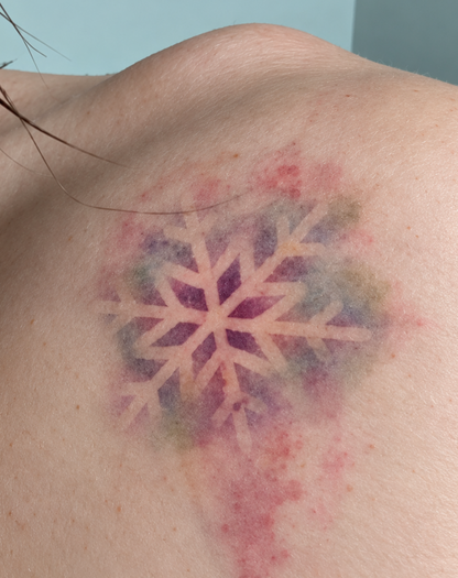 Frosted Scars Snowflake