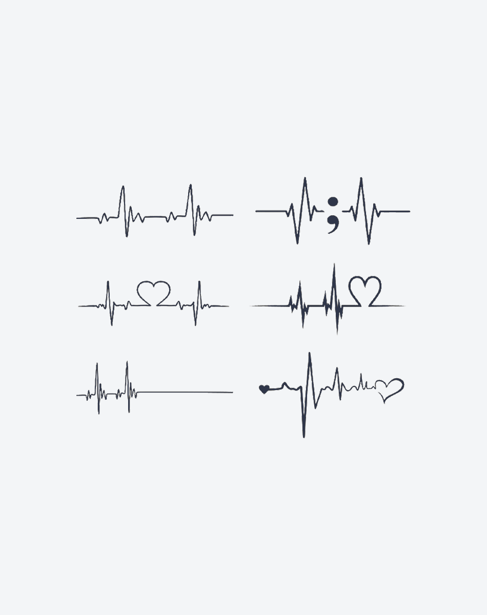EKG mit Liebe